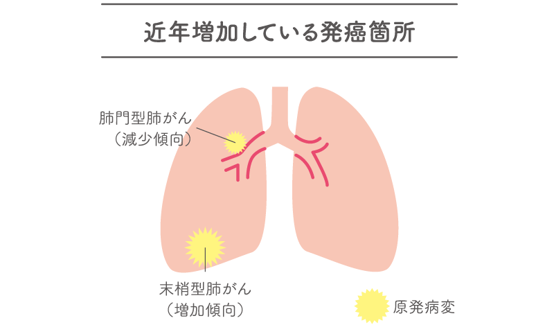 近年増加している発癌箇所